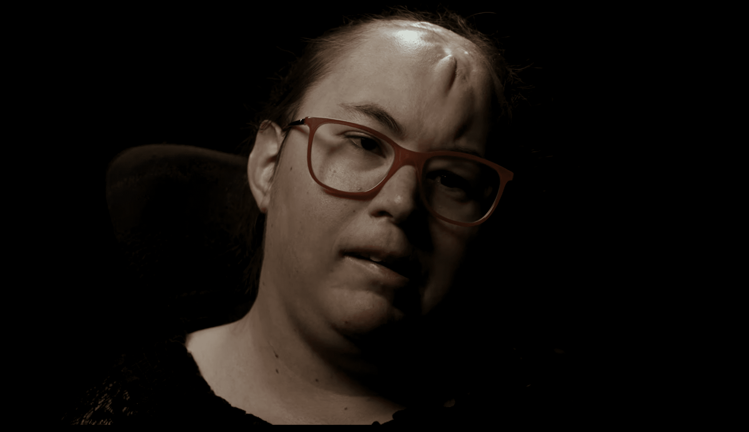 Portrett av Hope Hoffman, abortoverlevende med cerebral parese.
